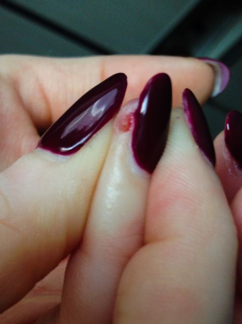 When Manicures Turn Dangerous Allergic Reactions And The Importance Of Client Assessments Rachael Divers Makeup Artistry