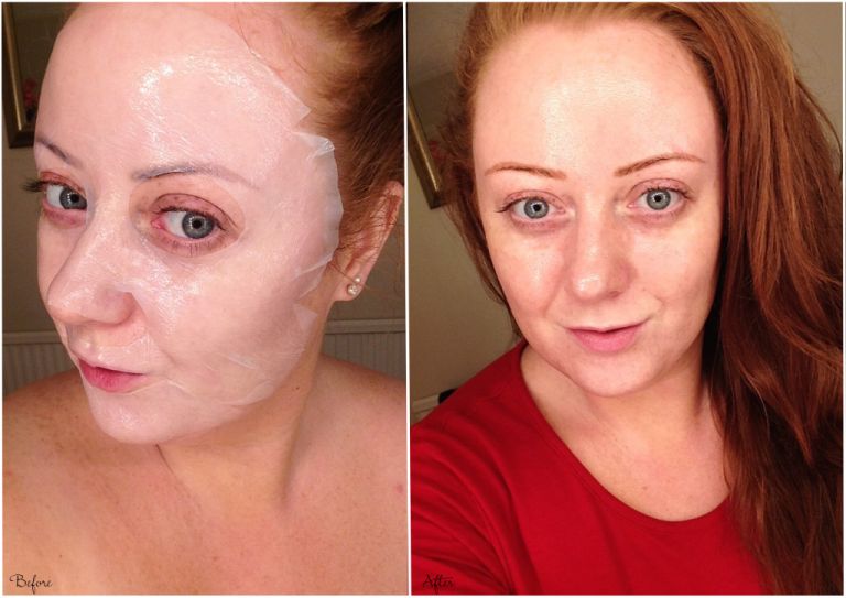 Before and After Starskin mask